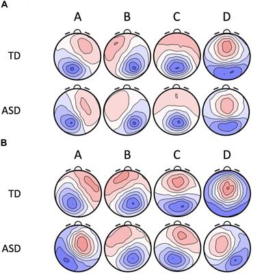 Children With Autism Produce a Unique Pattern of EEG Microstates During an Eyes Closed Resting-State Condition
